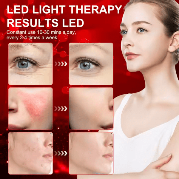 ⁦140LED 660nm 15/30/45 دقيقة الموقت العلاج بالضوء الأحمر⁩ - الصورة ⁦2⁩