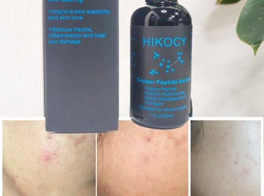 HIKOCY 30 ، ببتيد النحاس للعناية بالوجه