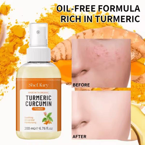 ⁦مجموعة مخصصة 5 Tumeric لمكافحة حب الشباب مزيل البقع الداكنة⁩ - الصورة ⁦4⁩