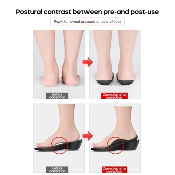 ⁦2pcs of Corrective Heel Pads Designed for Aligning⁩ - الصورة ⁦3⁩